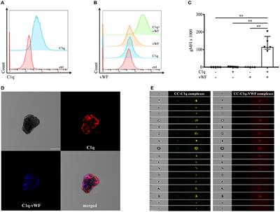 Binding of von Willebrand Factor to Complement C1q Decreases the Phagocytosis of Cholesterol Crystals and Subsequent IL-1 Secretion in Macrophages